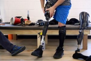 Prosthetics Artificial leg 