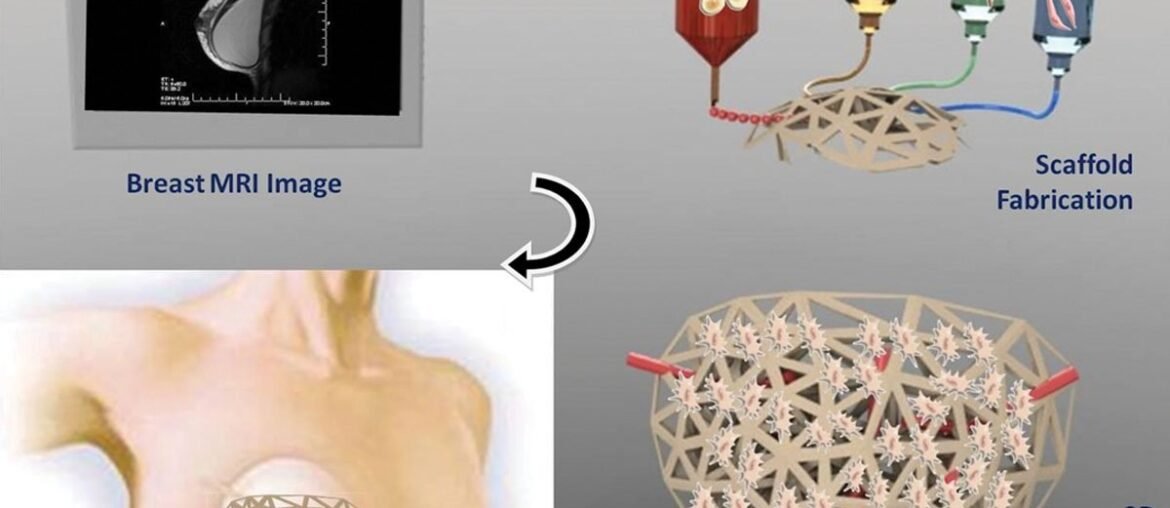 fabrication and characteristics of electrospinning/3D printing bones