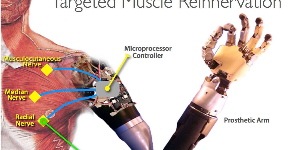 Artificial hand linked with the veins of the heart