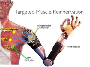 Artificial hand linked with the veins of the heart