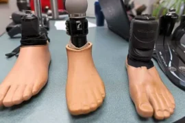 Soft-Tissue Prosthetics