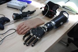 Prosthetics