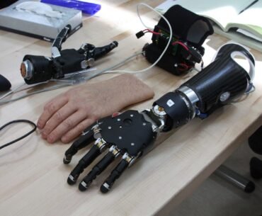 Prosthetics